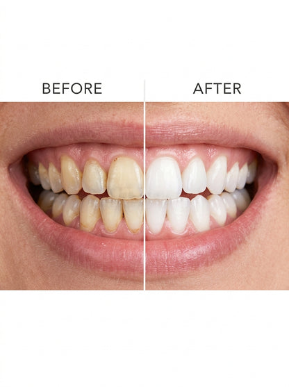 Teeth Whitening Strips